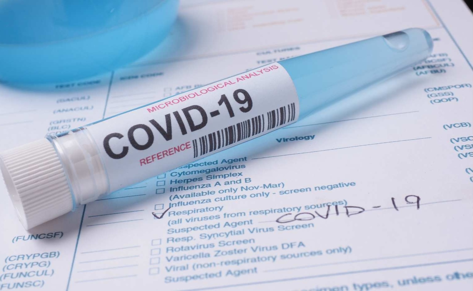Can acute COVID-19 awaken dormant cancer cells?